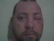stunginface_thumb.jpg